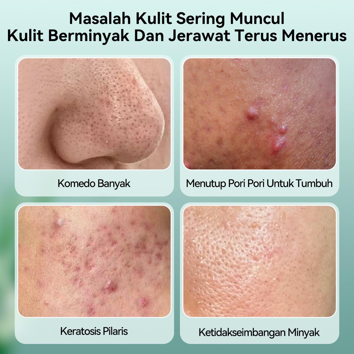 Product detail media - 1